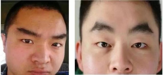 Baby哥相面之 二 兄弟宫各位宝宝大家好 Bab 圈子 新氧美容整形