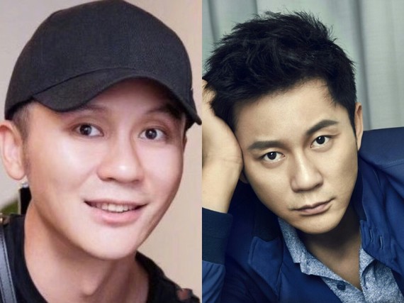 美商提高今天我们来聊聊,关于眼窝凹陷的那些事~平_圈子-新氧美容