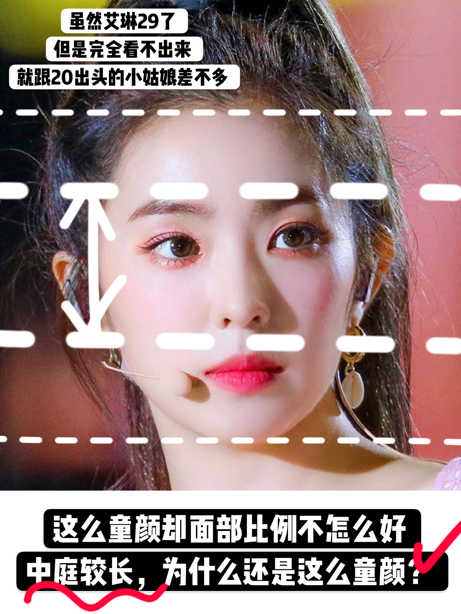 艾琳到底多么_圈子-新氧美容整形