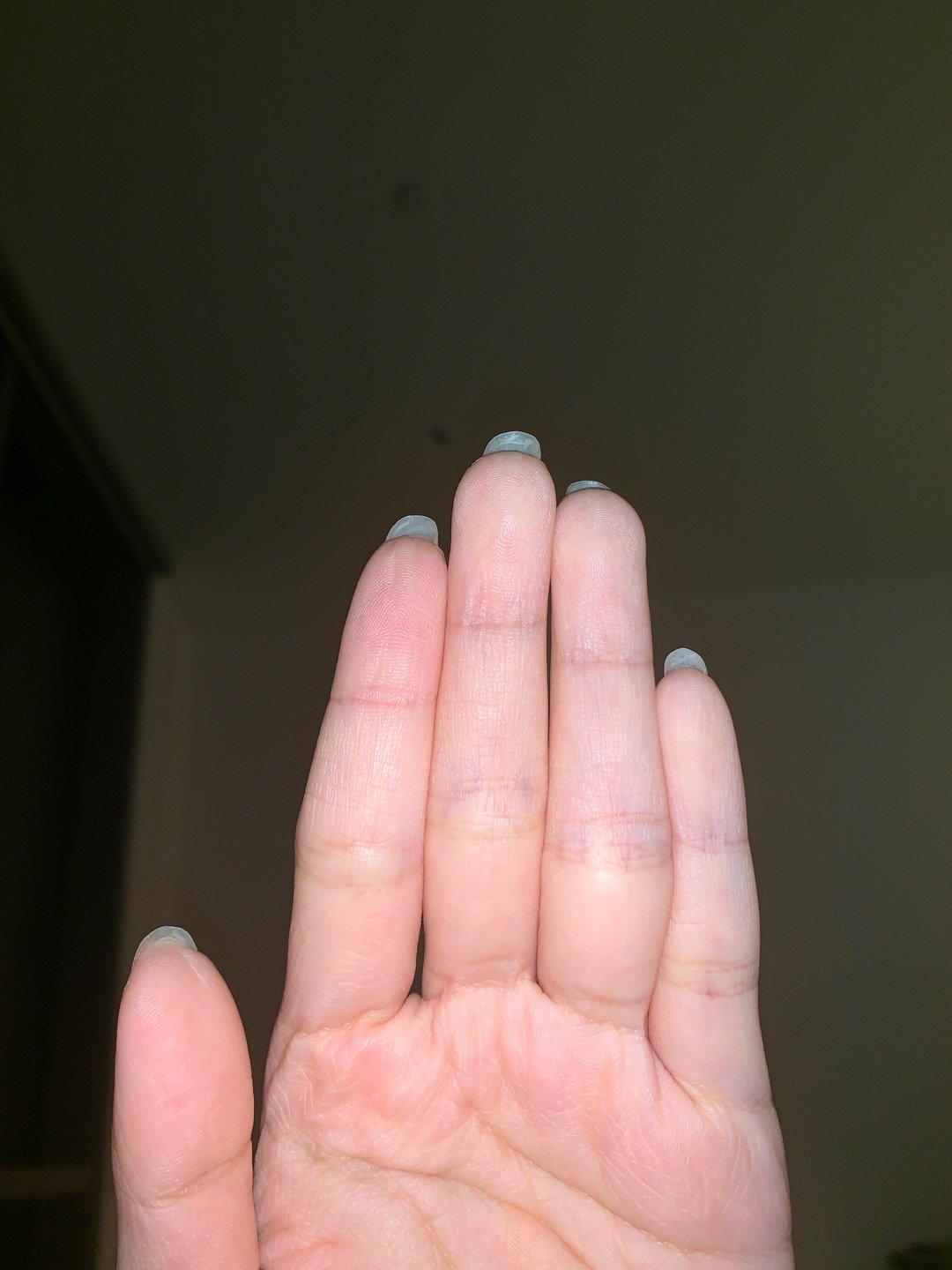 两只手都是无名指比食指长哈哈哈