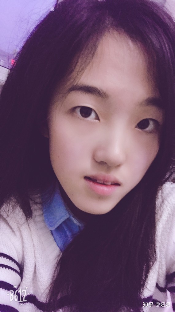 初中时候兜齿,矫正牙齿之后还是能看出来,但是上牙能包着下牙了