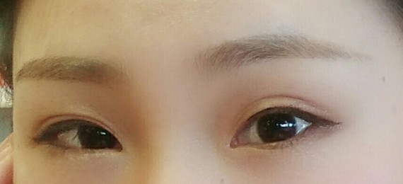 原来两个眼睛双眼皮不一样.