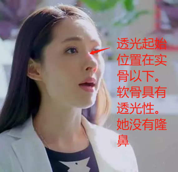 鼻子透光,一定是因为做了鼻子吗