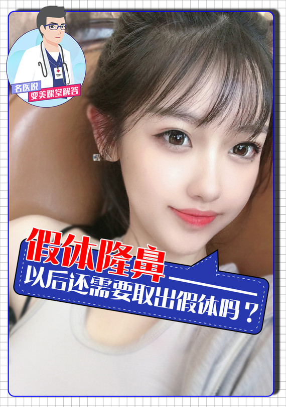 假体隆鼻以后还需要取出假体吗隆鼻假体有保质