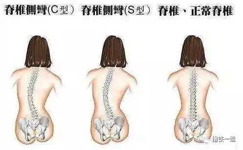 健博一姐上线颈椎的问题一姐已经说得脑袋都大了,但很_圈子-新氧美容