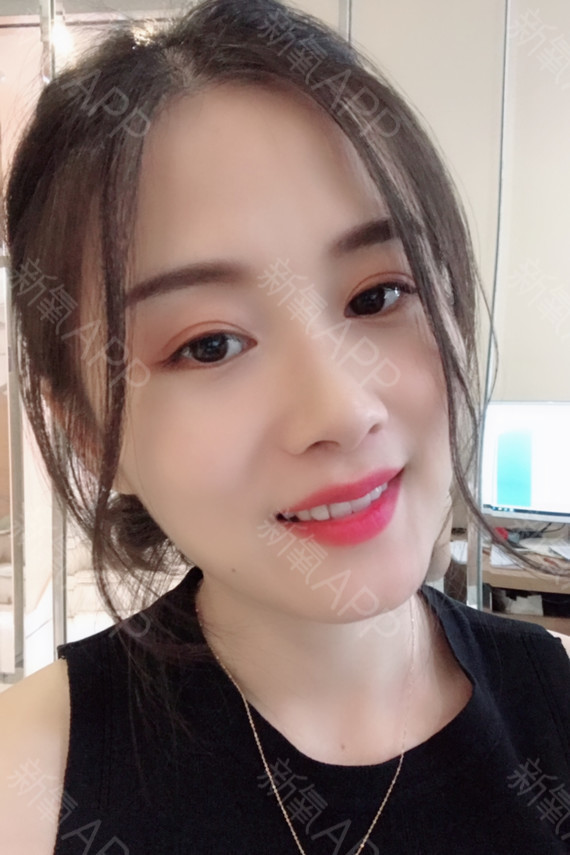 双眼皮术后都会出现哪些并发症,应该怎么处理?