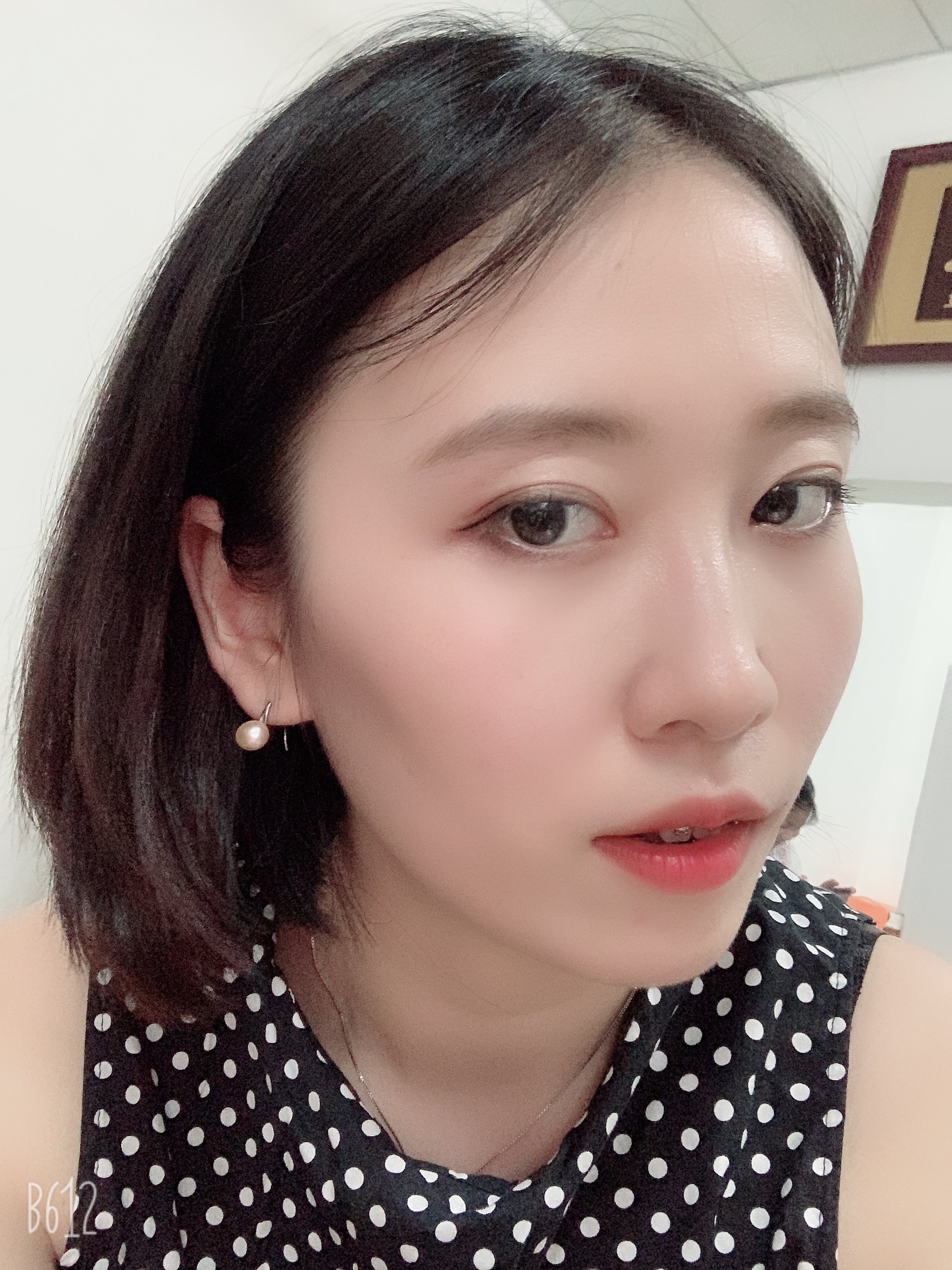 听说超体隆鼻是目前最先进的鼻整形手法,想问一下,超体隆鼻适合咱们