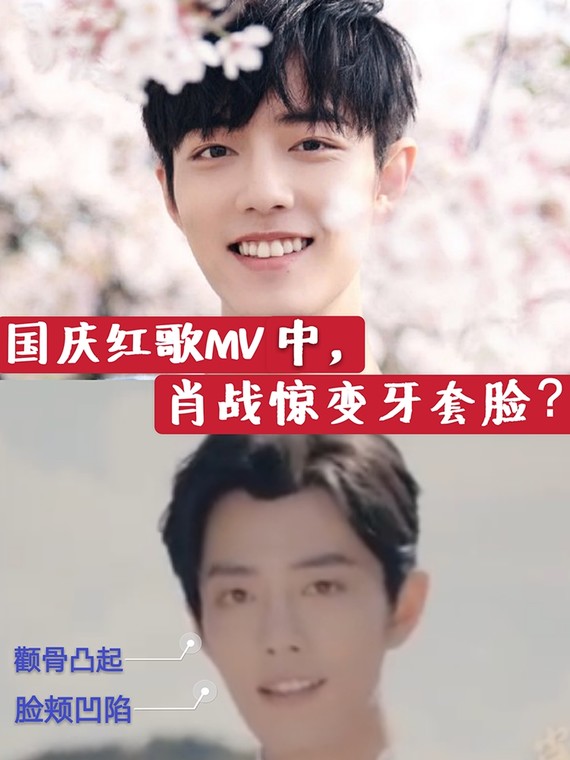 肖战也是牙套脸