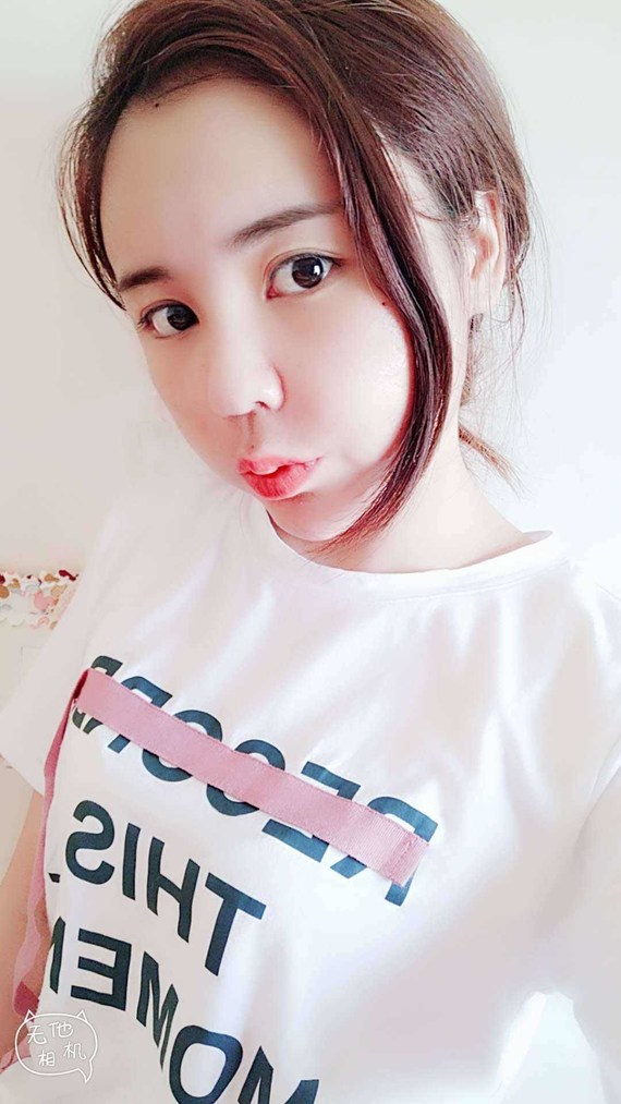 圈子-新氧美容整形