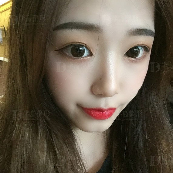 圈子-新氧美容整形