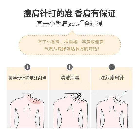 打完瘦肩针不小心被按摩了一下 新氧 专业医美服务平台