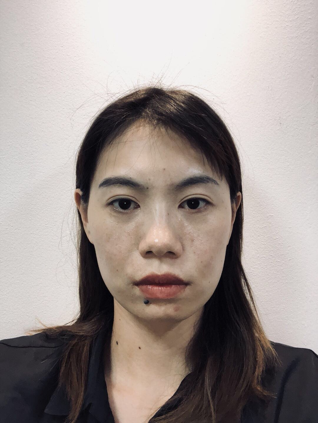 突嘴好像不是牙的问题 法令纹很重要怎 新氧美容整形