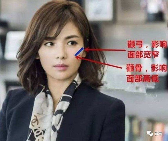 而刘涛这种颧弓外扩的长相嘞就会在视觉上拉宽面部,不仅显得脑袋很大