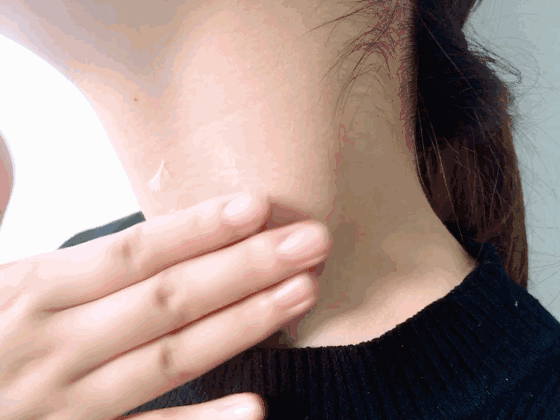 有人说,颈纹=脖子上的"年轮",往往颈纹深的人看起_圈子-新氧美容整形