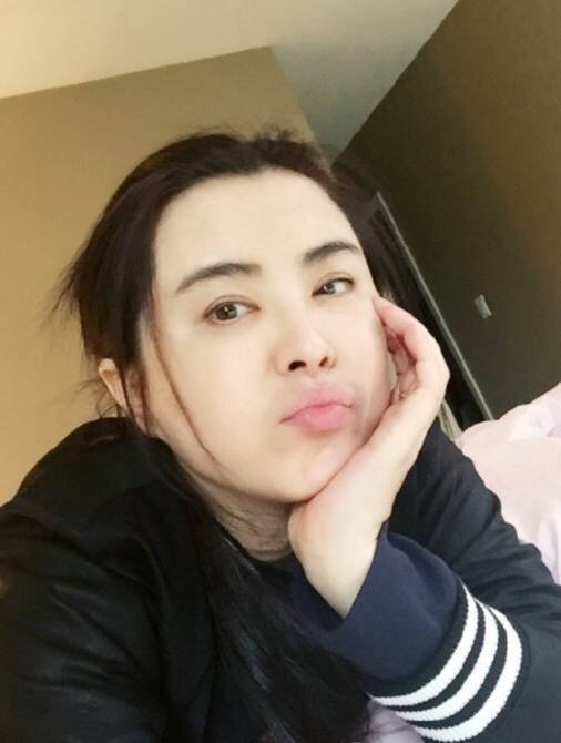 07什么是u型脸?顾名思义,_圈子-新氧美容整形