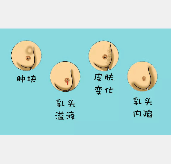 孕激素影响,导致发育敏感强的一侧乳房发育过快,而另一侧乳房发育过缓