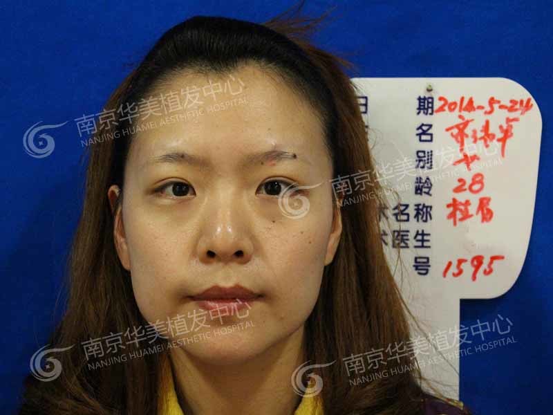 纹眉好还是种植眉毛好 新氧美容整形