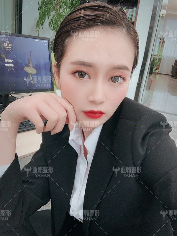 别人都是隆鼻 我这个歪鼻怎么办 隆鼻 新氧 专业医美服务平台