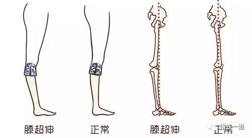 位置偏移后,为了保持身体的平衡,小腿就会发力拉住身体.