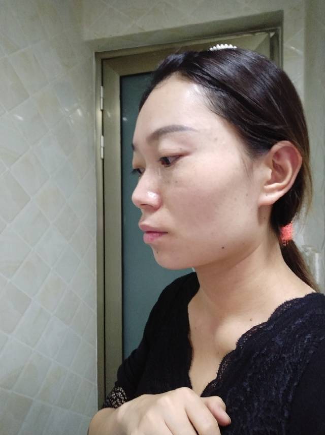 我觉得自己长得特别土,颧骨高,颧弓宽,下颌角特别方,看上去脸特别大