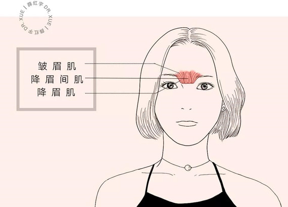 如图所示,△当皱眉肌,降眉间肌,降眉肌收缩时,▽就会出现眉间