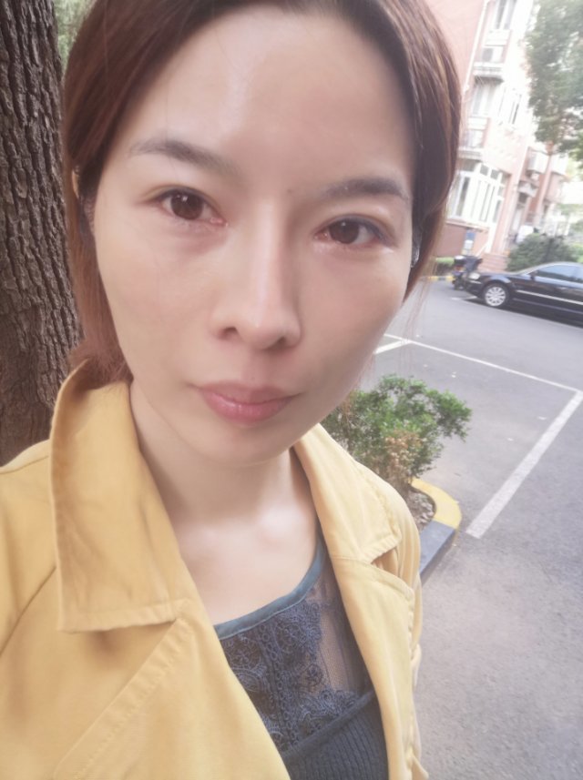 一脸戾气的时候,即便面目清秀,给人感觉也是不大好看_圈子-新氧美容