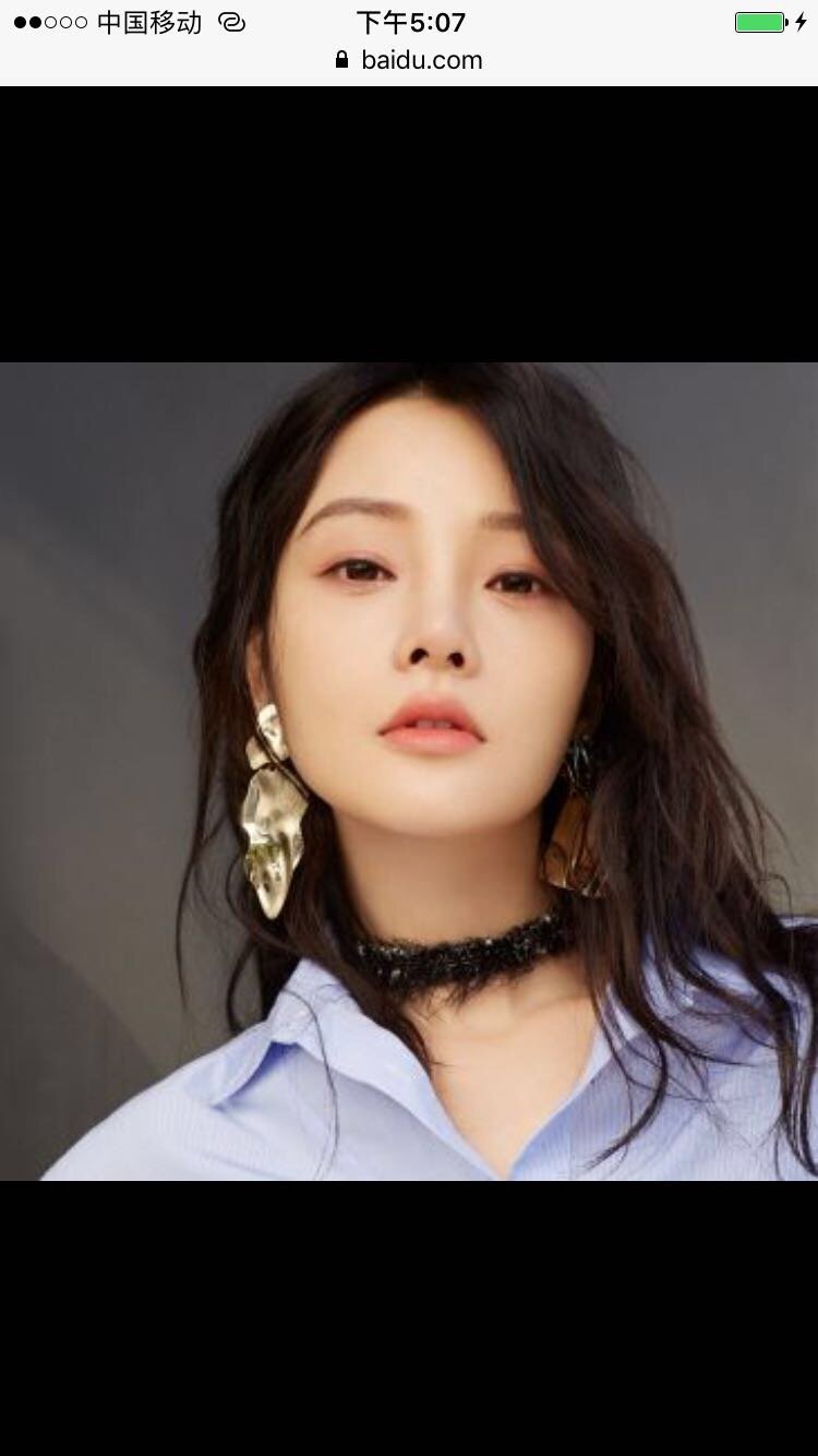 刻薄脸的特点说一下 1:颧骨高 太阳穴凹 2:眼窝_圈子-新氧美容整形