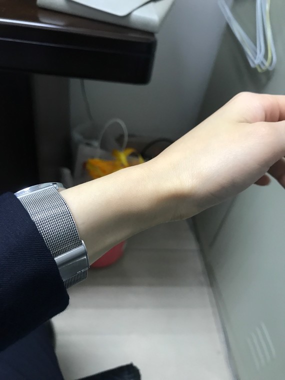 一直觉得自己手腕很细,觉得自己应该是扁身,但是我高_圈子-新氧美容