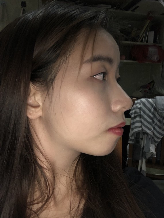 圈子-新氧美容整形