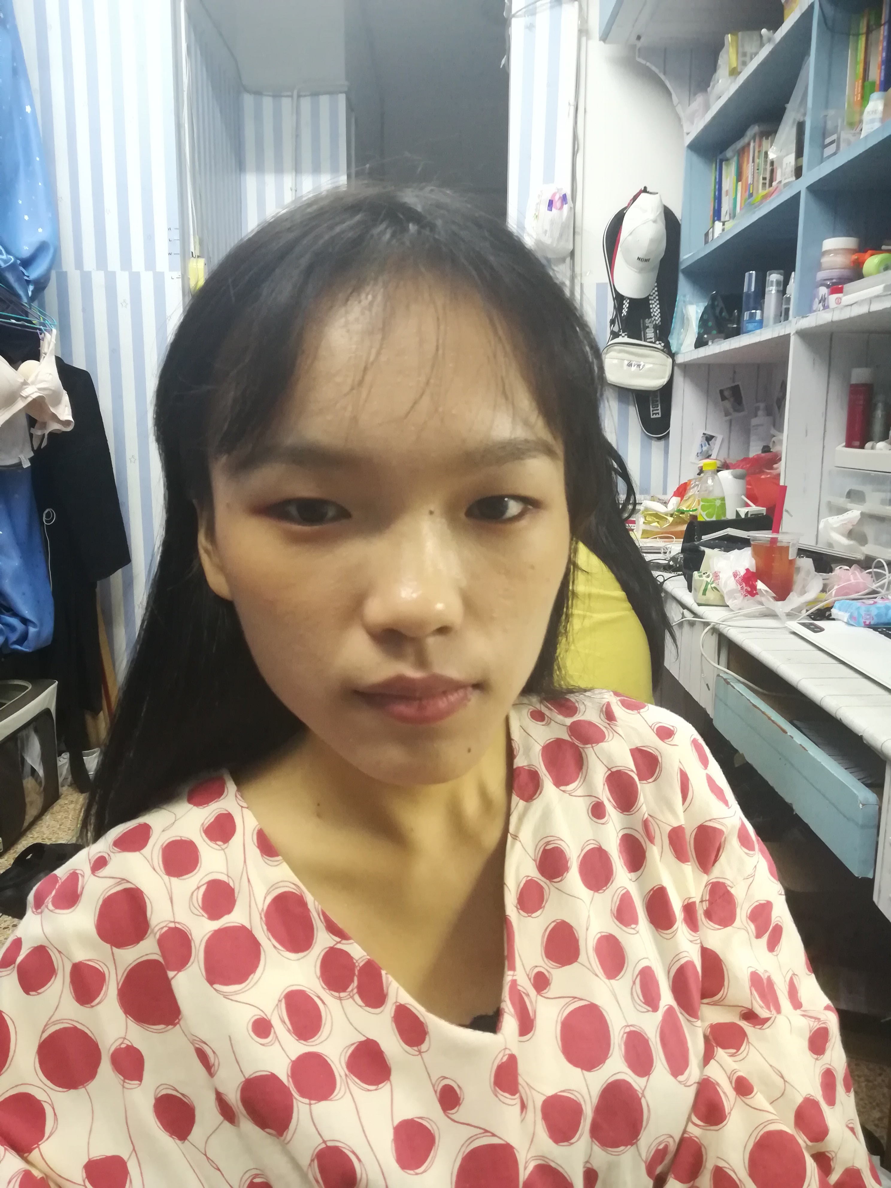 脸歪,以为脸歪是牙齿咬合不正,后来看了牙医,说挺正常的,还有一妇就