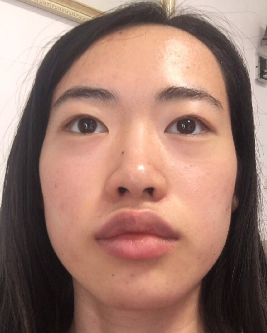 我觉得自己眼睛不太好看 嘴唇太厚了 鼻头有点肥大 比较喜欢半藏森林
