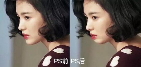 当女明星失去了下巴最终退出了港姐的比赛邱淑贞当年也曾因为下巴被