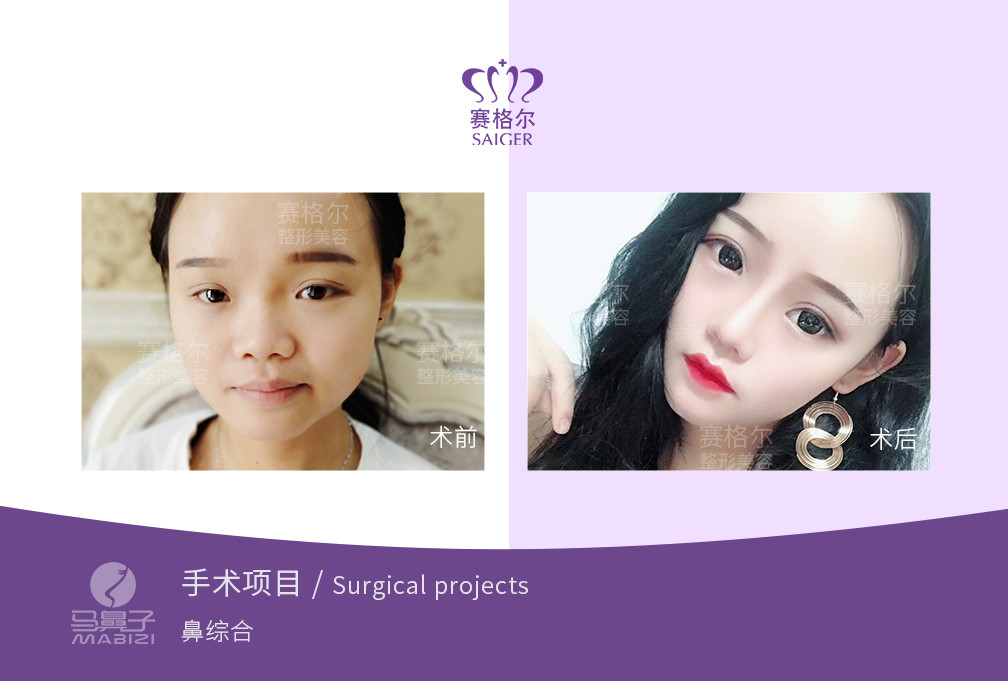 你好,我是重庆马鼻子,很高兴为您解答