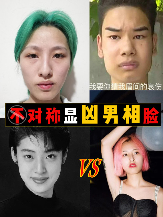 不对称显凶男相脸 这位宝宝想要改善脸的不对称以及 圈子 新氧美容整形