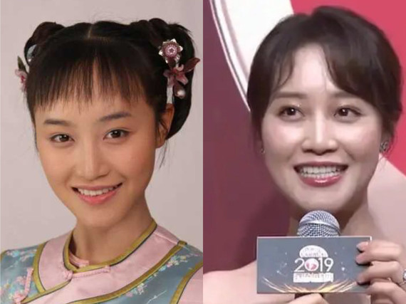 昨天蓝盈莹出席电视剧《精英律师》的定档宣传活动,以_圈子-新氧美容