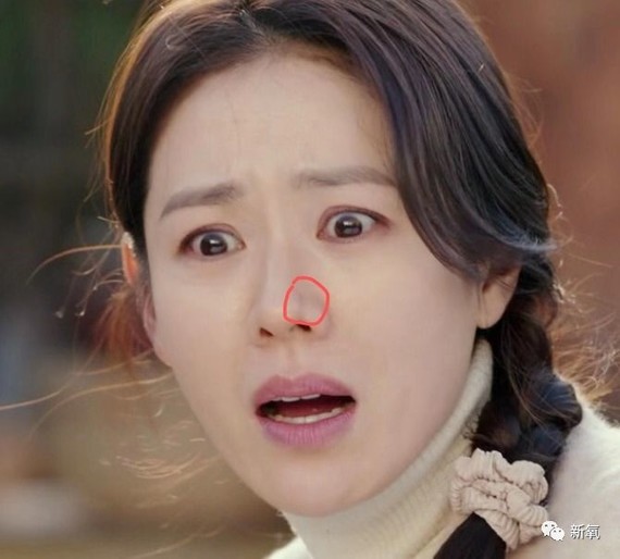 羊随便找了个片段看了一眼,她鼻子上的这个问题确实挺明显的,远远看像