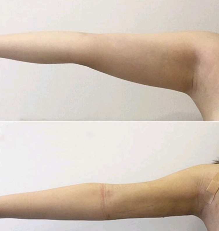 胳膊特别粗壮 上半身胖