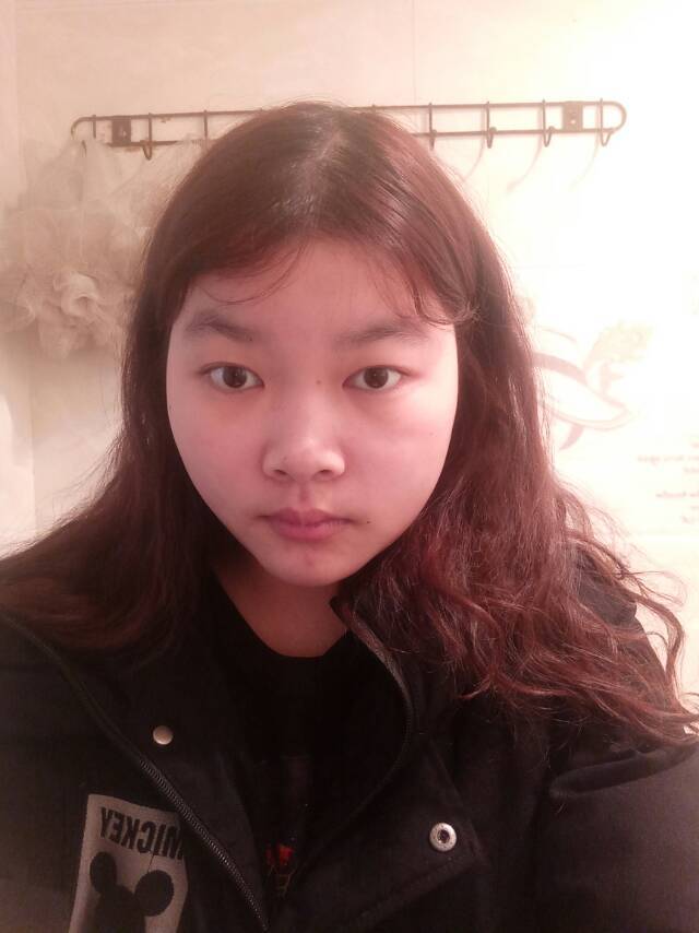 面部过于平庸,由于脸部骨架大,一直给人感觉脸特别大.