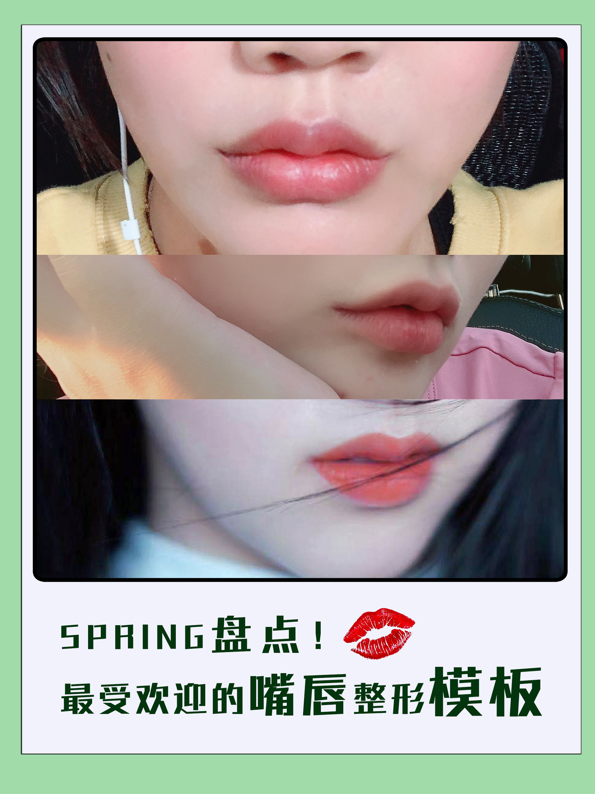 盘点 最受欢迎的嘴唇整形模板 海鸥唇 蜜桃唇 圈子 新氧美容整形
