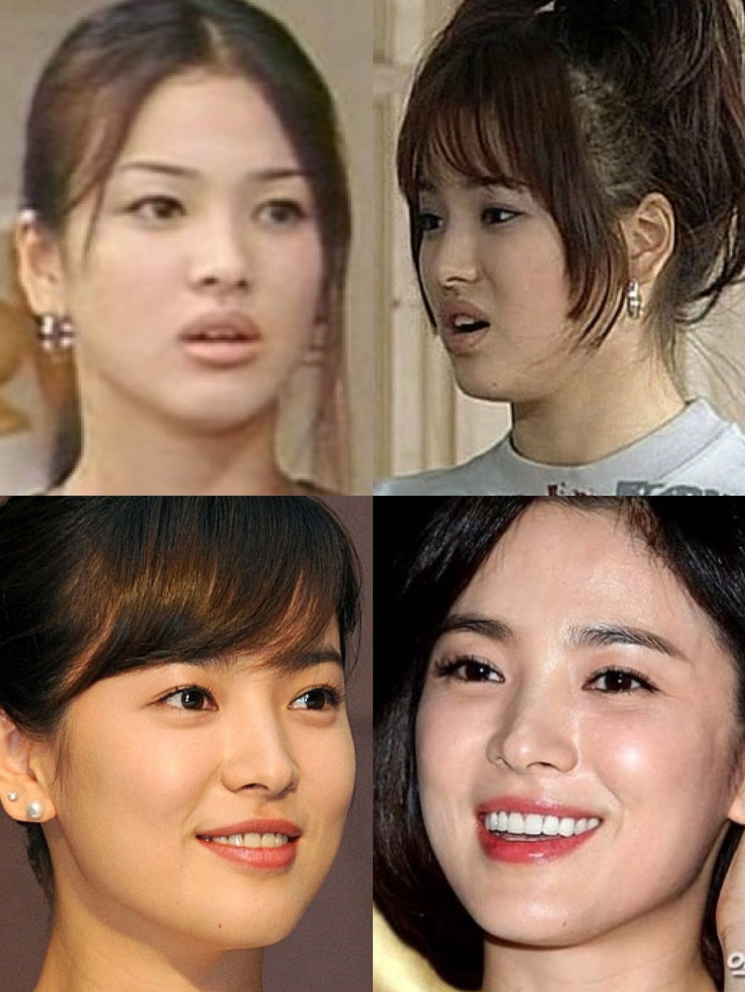 宋慧乔这样微调才变女神脸-以前说到韩国纯天然美女,_圈子-新氧美容