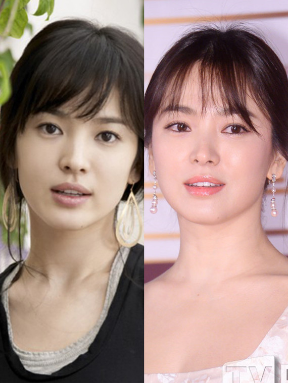 韩国纯天然美女,大家肯定想起宋慧乔,但是就在几年间,疑似宋慧乔整容