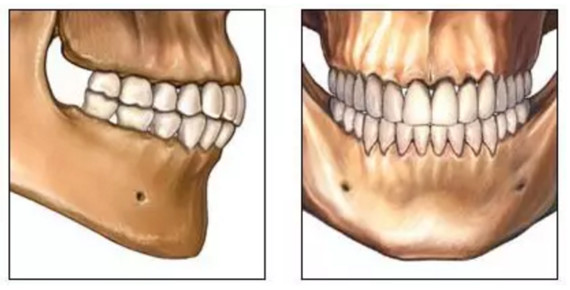 经常口腔溃疡只是因为缺维生素b吗要警惕是你的牙齿咬合出现了问题哦