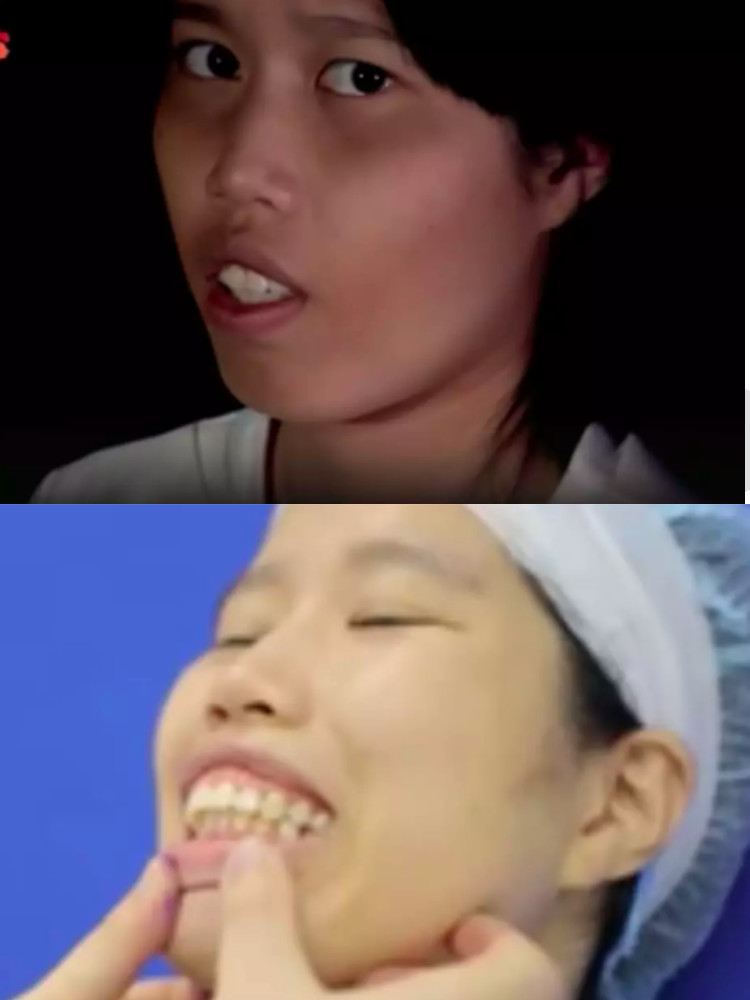 龅牙 地包天的大妈变少女!绝对是换了整个头