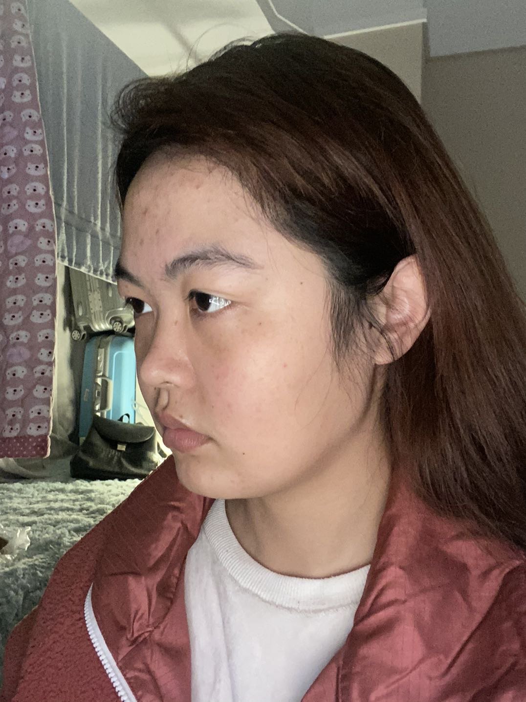 显得脸特别平 正面拍照很丑 只能看见两个鼻孔… 2.眼睛.