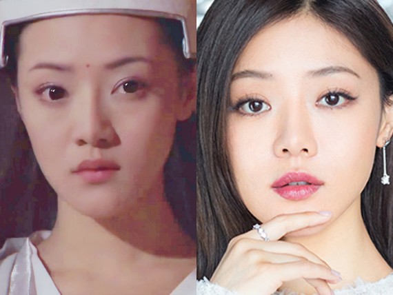 本期跟着明星学整容会说到的整形方面的建议和内容如下