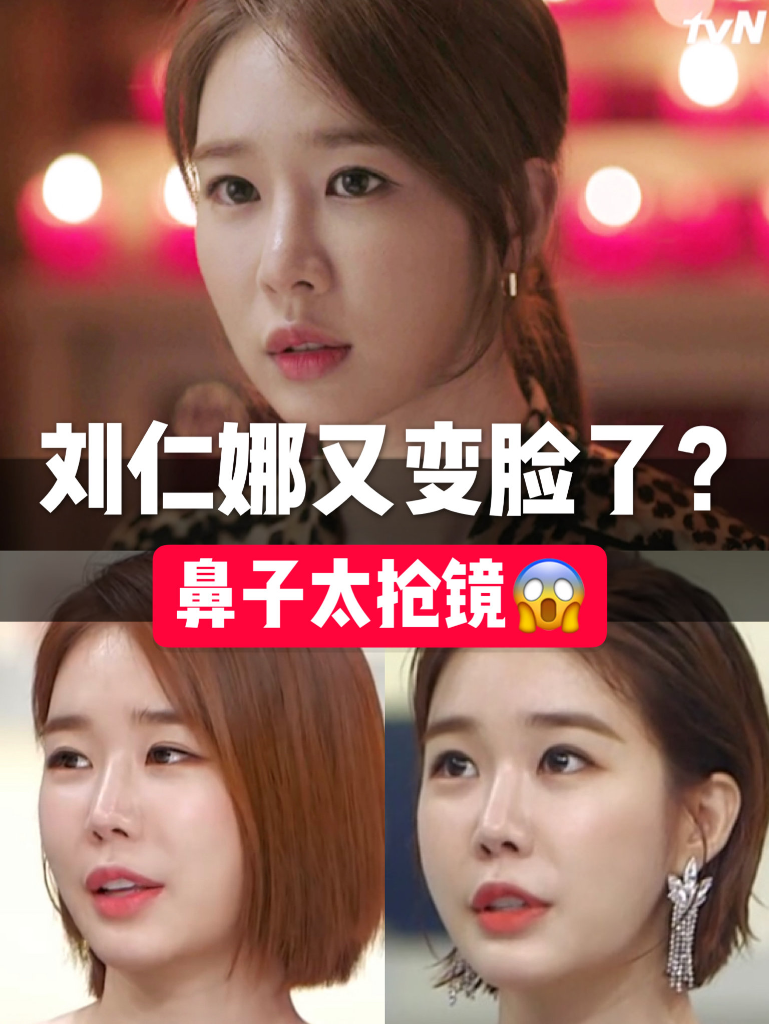 刘仁娜的鼻尖太高太尖,跟脸不协调!- 有一种整容叫_圈子-新氧美容整形