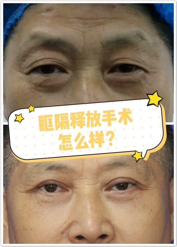 (注,此图是郭荣医生做过的真人案例)