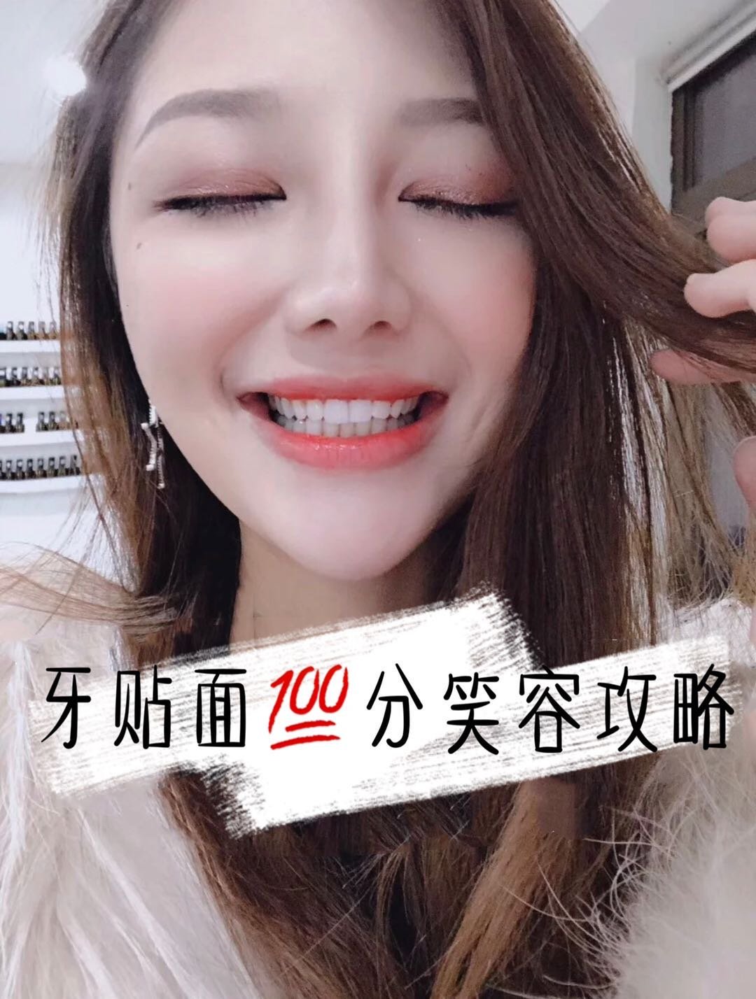 牙齿美白|牙贴面分笑容攻略