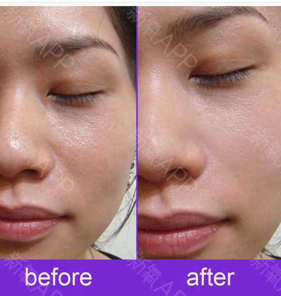 泰国初恋女神的小水逆袭全靠美白