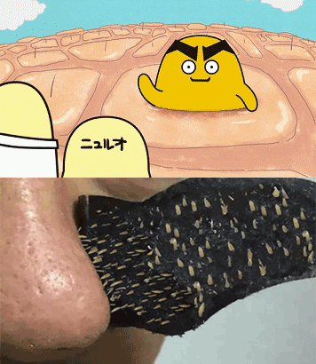 黑头是一种开放性粉刺,与白头一样,都是_圈子-新氧美容整形